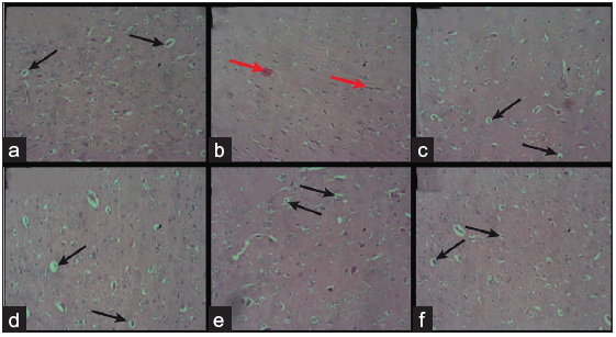 (a) A photomicrograph of the control group and the neuronal cells are interspersed within the neural tissue (black arrows) (b) cytoarchitecture with very mild signs of the onset of tissue traumatic encephalopathy (red arrows). (c)–(f) Several neuronal cells interspersed within the neural tissue and their cytoarchitecture appears normal (black arrows). [Hematoxylin & Eosin stain x200]